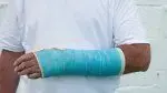 man-in-arm-cast---preventing-injury-157506178.webp