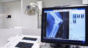 X-Ray technitian taking a x-ray of a knee due to popping joints