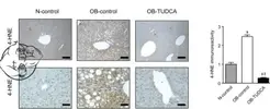 tudca-liver-lipids.webp