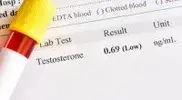 Testosterone-Blood-Test-Results-Low-Hormone.webp